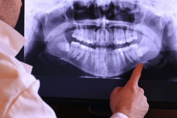 Best Tooth Pain Emergency Relief  in Cridersville, OH
