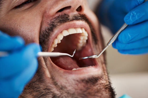 Best Emergency Tooth Extraction  in Cridersville, OH