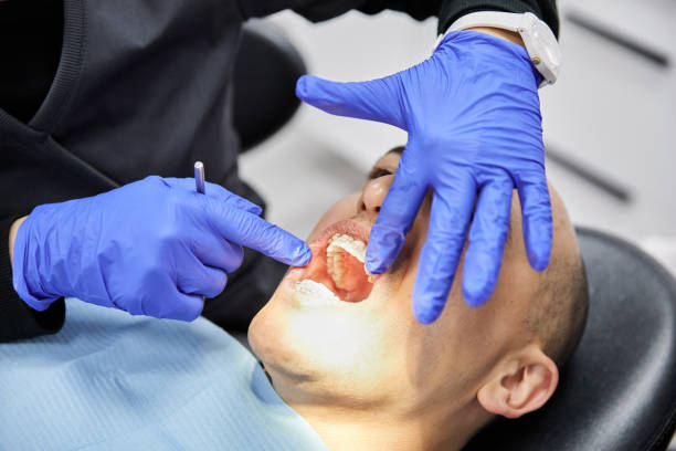 Best Root Canal Emergency Dentist  in Cridersville, OH